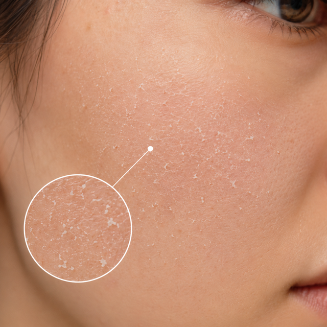 Pourquoi mes soins peluchent sur la peau ? Les 4 erreurs (et la routine anti-peluches)
